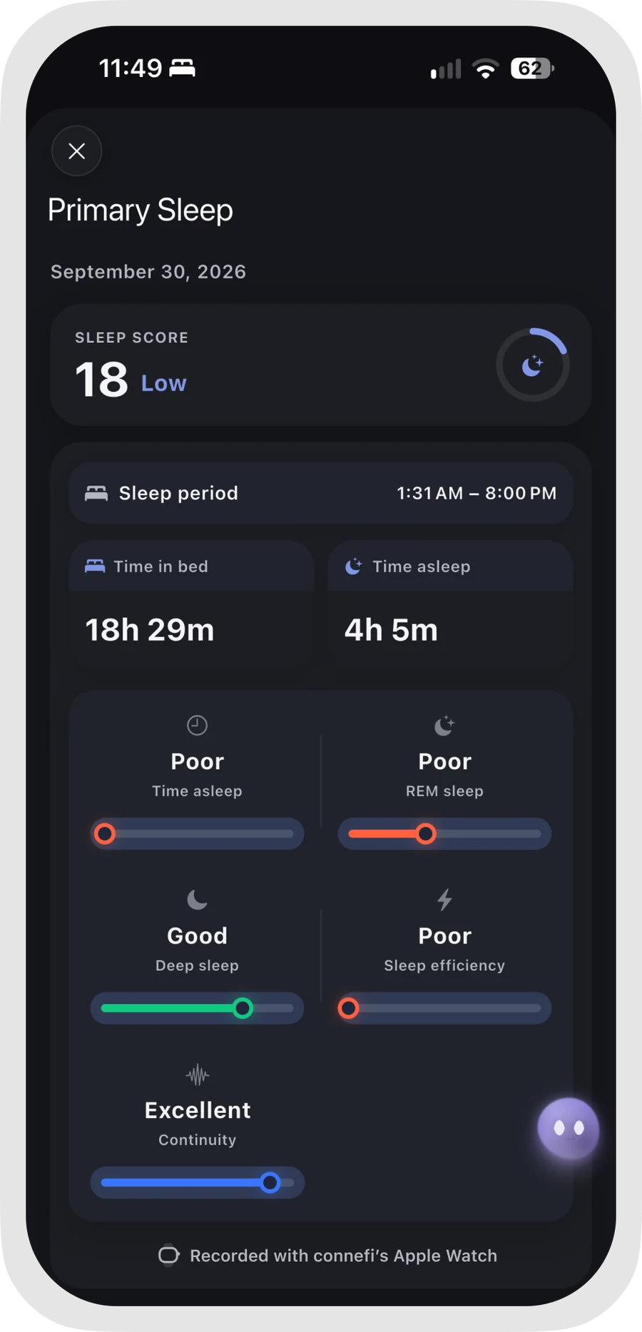 Primary Sleep with recorded time in bed and time asleep. This supplied example contains an unusually long sleep period.